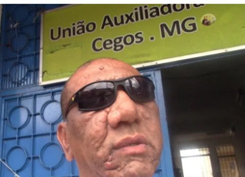 Abraço à União Auxiliadora dos Cegos